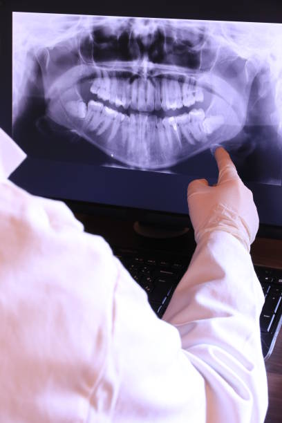 Best Emergency Dentist for Knocked-Out Tooth in New London, OH