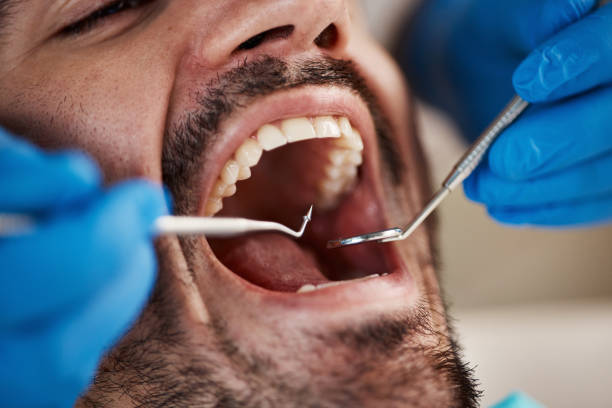 Best Emergency Dental Services for Seniors in New London, OH