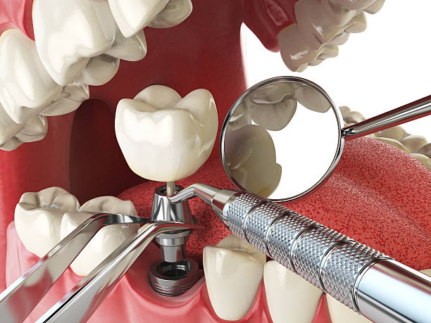 Best Holiday Emergency Dentist in New London, OH