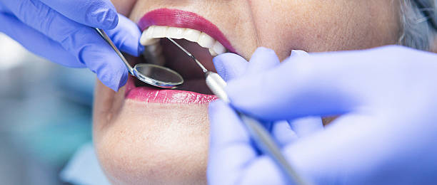 Best Emergency Dental Care for Abscessed Tooth in New London, OH
